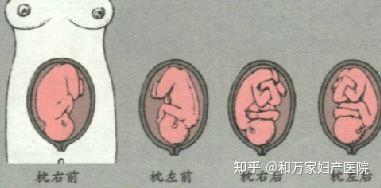 v2-e4e18c7acacb66709aeca4884115bdaa_b.jpg