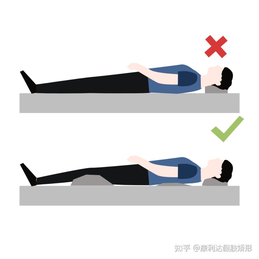 脊椎侧弯最佳锻炼方法