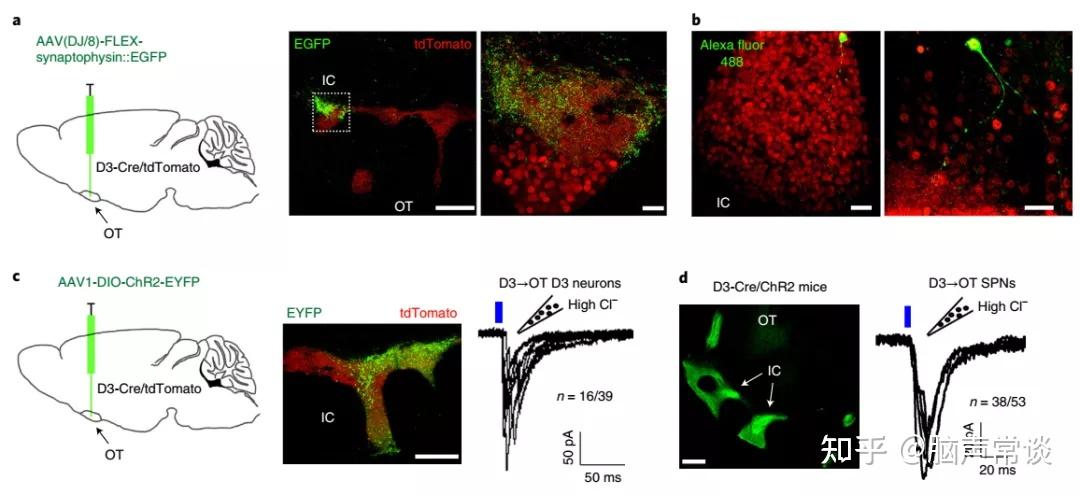 natureneuroscience科学家揭示腹侧纹状体亚区调控自身清洁的行为