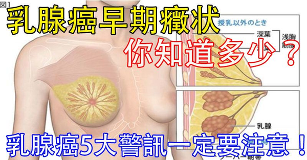 鼻前庭癌早期症状 鼻前庭炎能自愈吗 鼻子左侧肿痛一按很痛