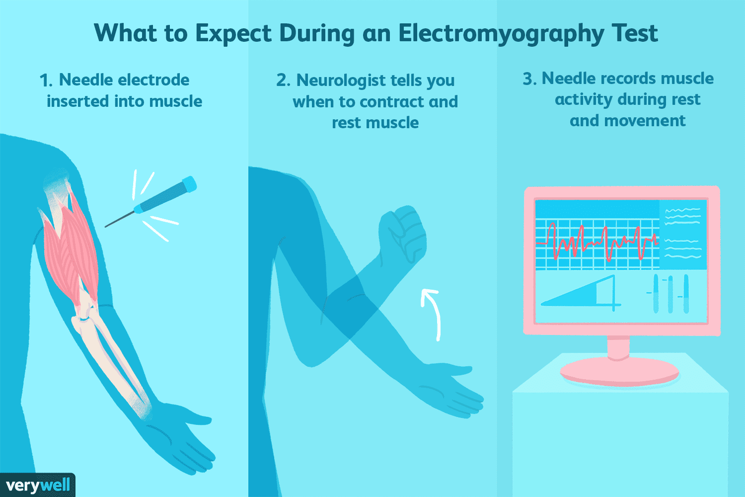 what-is-electromyography