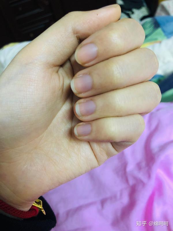 手指甲半截为什么看起来灰色的