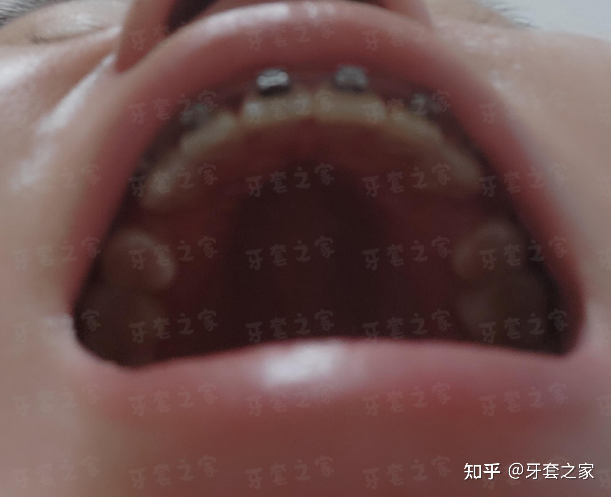 v2-e595db873a17a449e89d7f6b2b7c6022_r.jpg