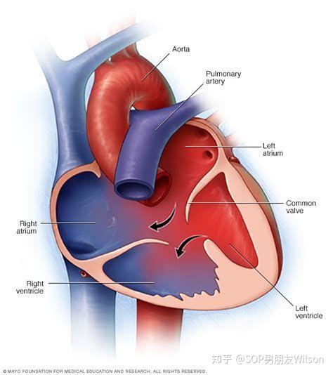 心房心室图四格图片