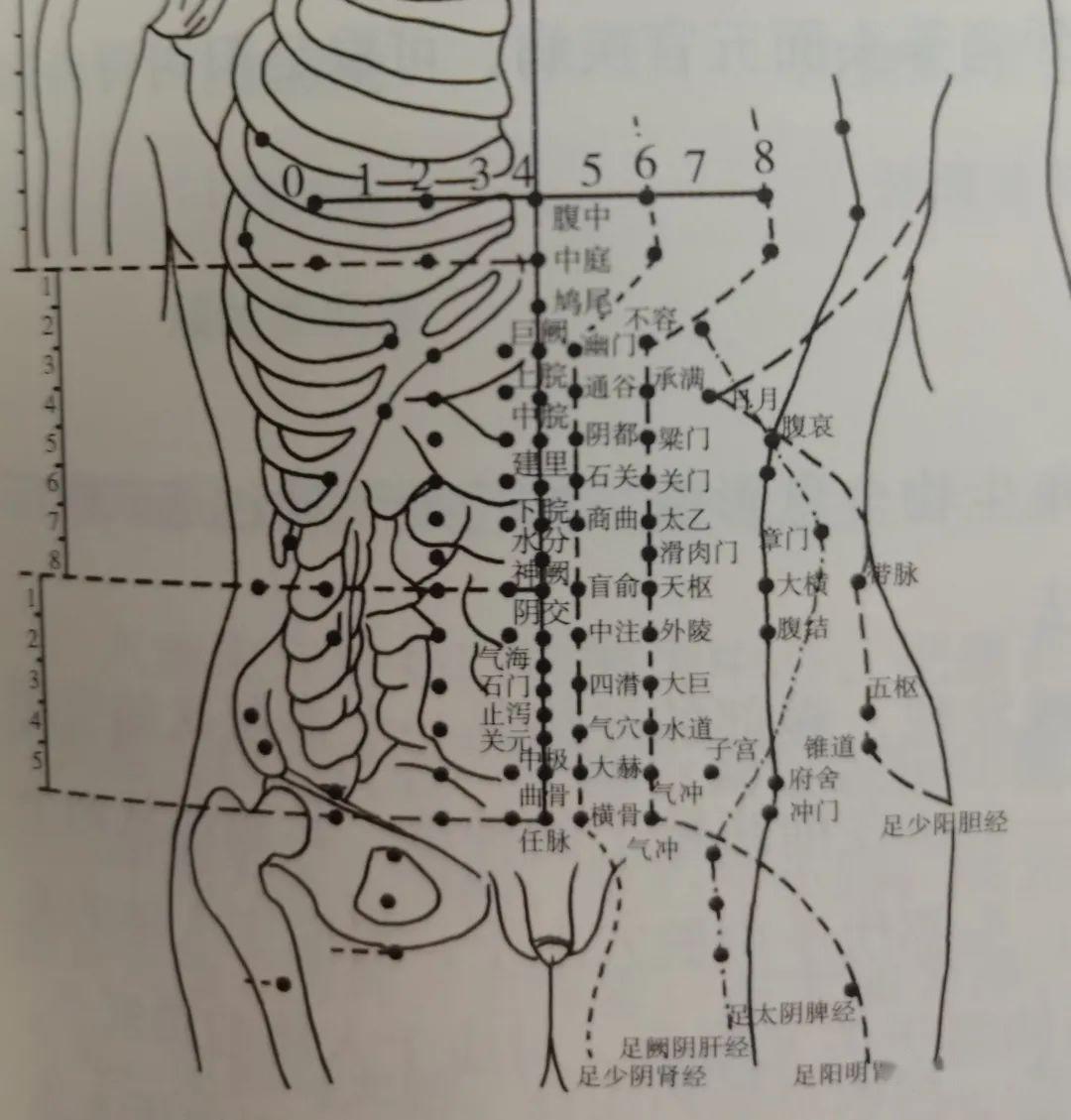 针灸微针—腹针疗法