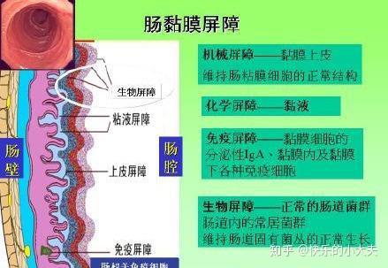 肠道的4道屏障保证着人体每天健康运转