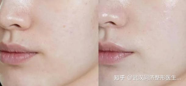 舒敏之星究竟是什么?它可以解决哪些皮肤问题? - 知乎