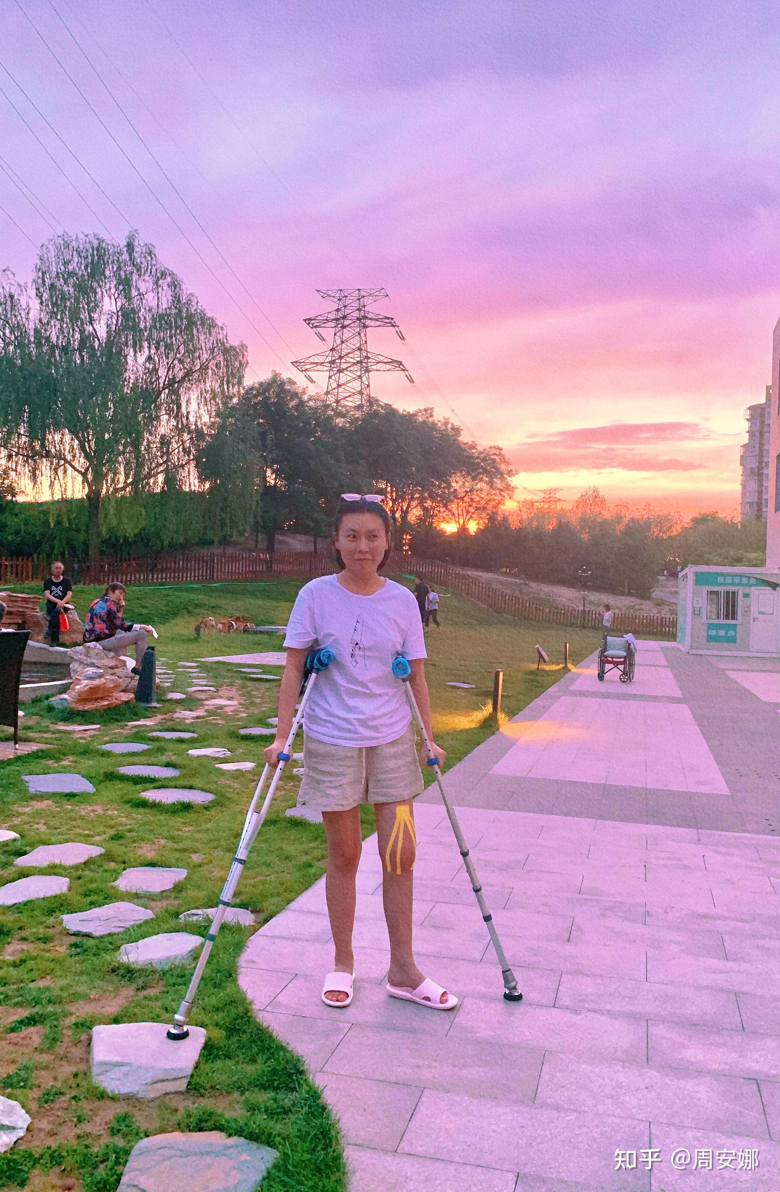 那时候拄双拐走路,要努力控制才能让脚不外撇.