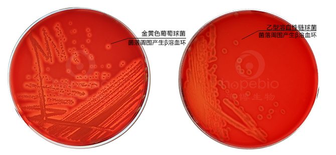最通用的厌氧菌固体培养基：哥伦比亚血琼脂背景概述、应用场景和配置说明 知乎 