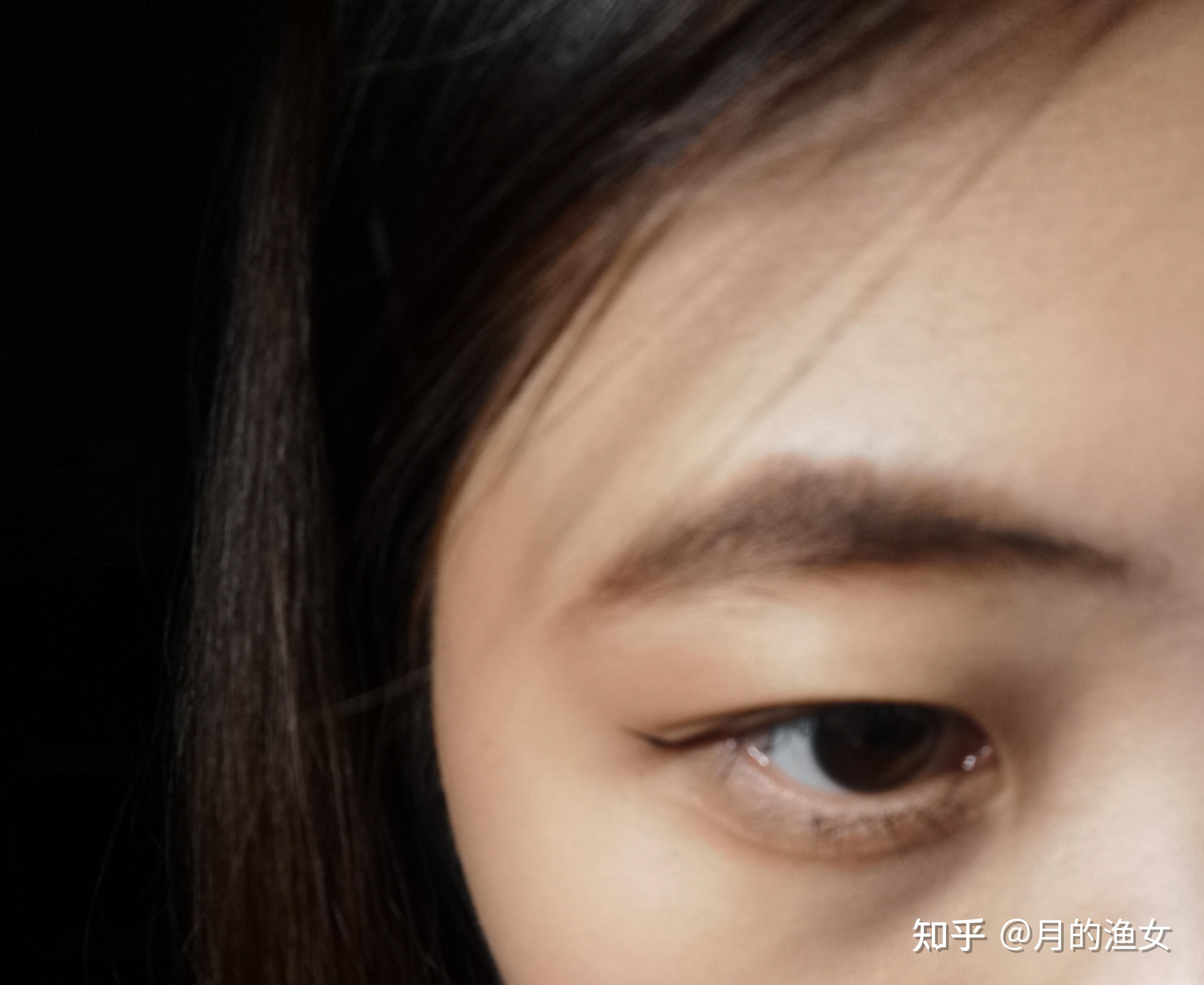 感觉自己的眼角很奇特但是为什么会有那么深的凹陷呢