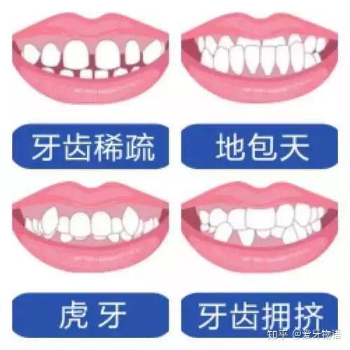 v2-e68d3f68e917794f25cba4c66f87e3d6_r.jpg