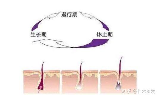 别再相信那些药水生发，植发确定不了解一下？ - 知乎