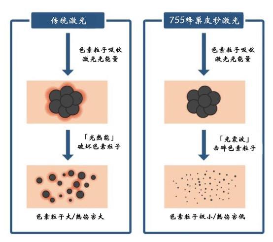 蜂巢皮秒的作用与功效图片