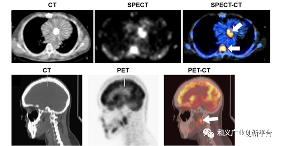 核医学(2)——PET和SPECT诊断设备，一个价值千亿的市场，各类产品竞争如何？ - 知乎
