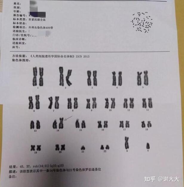 两次胎停13号染色体多一条是否要进行三代试管