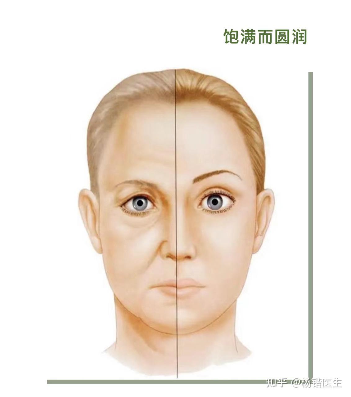 面部凹陷才是年龄感的Bug - 知乎