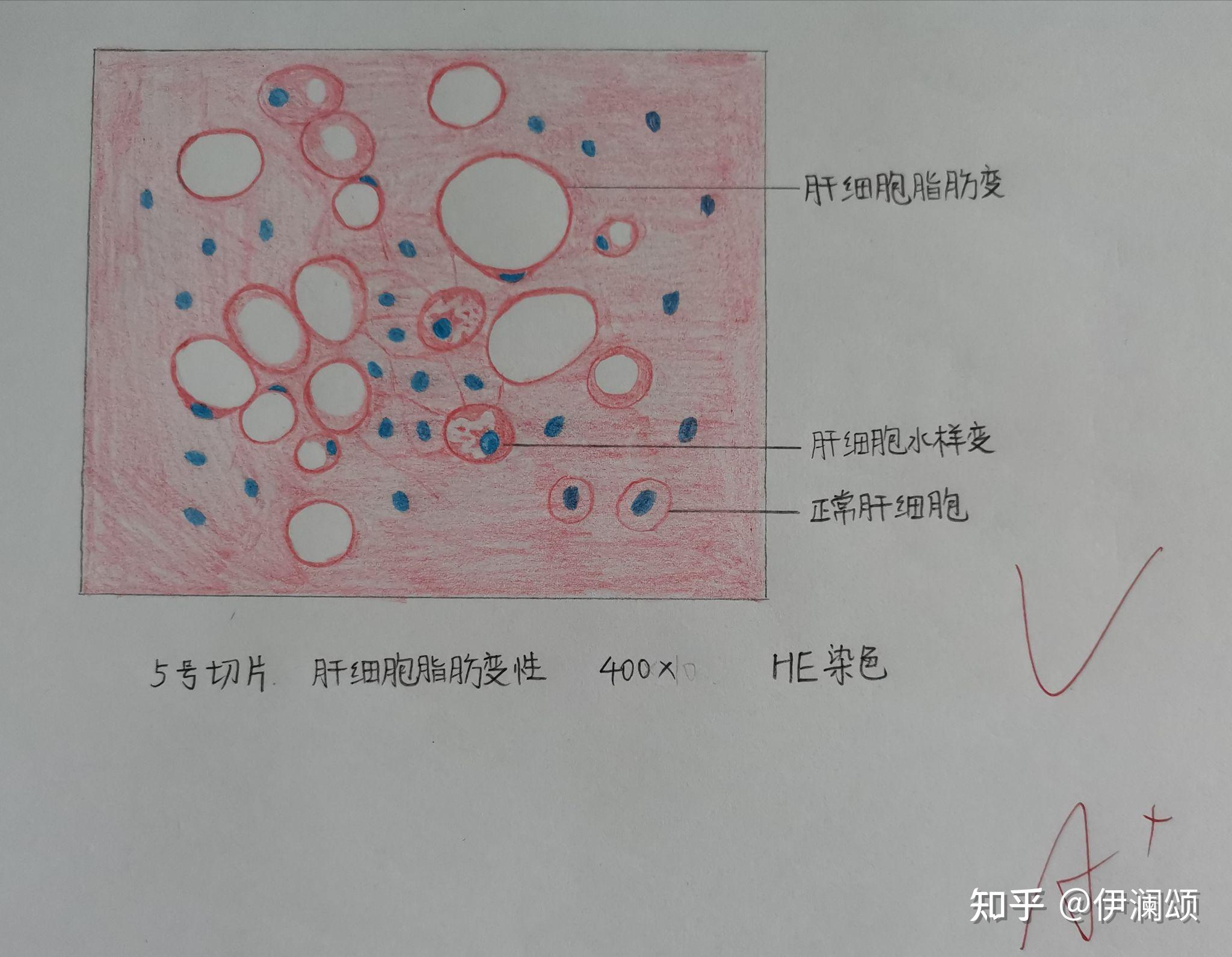 中性粒细胞手绘图片
