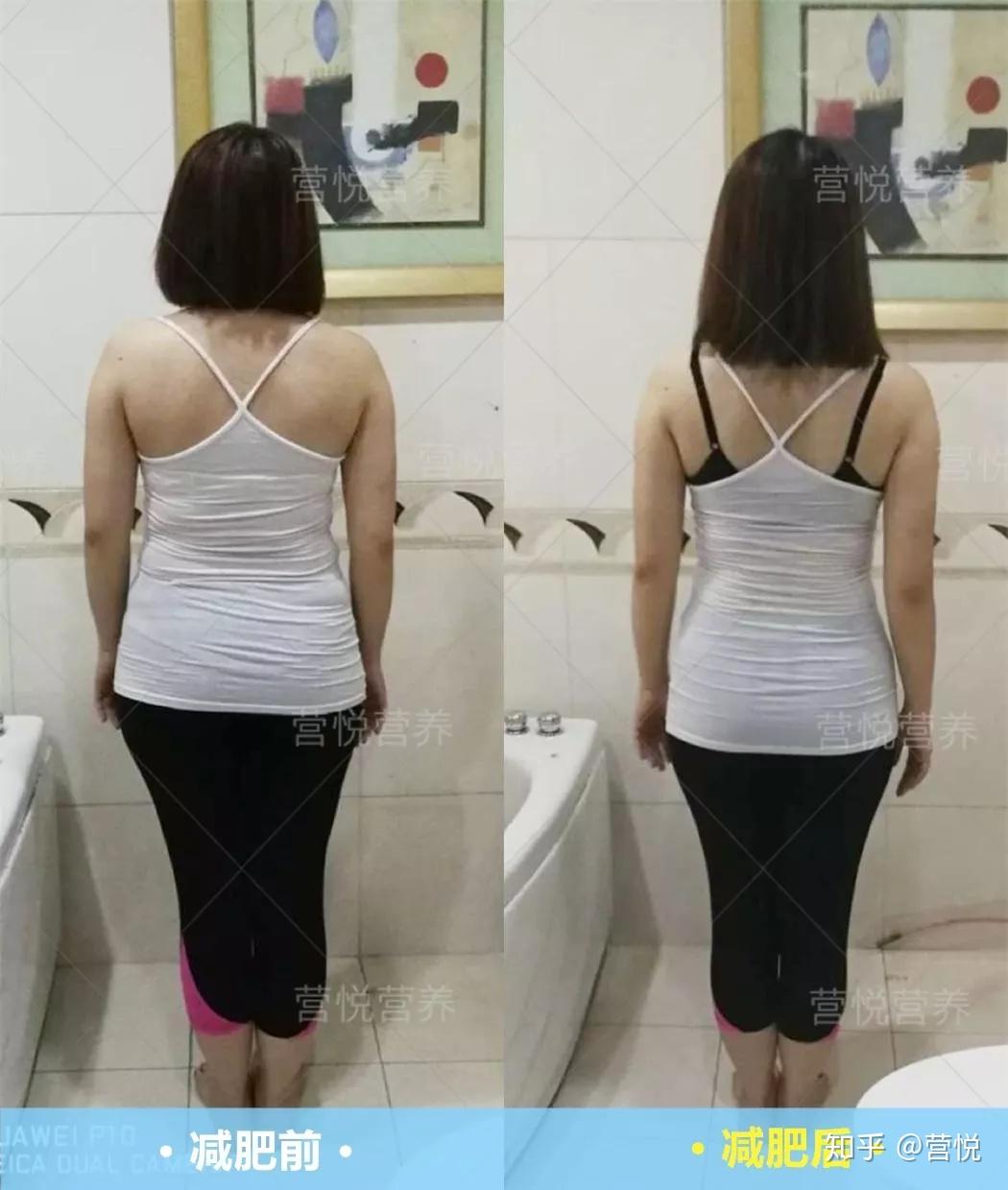 我属于产后肥胖,自从胖了之后,穿衣服不好看了,整个人也没有了以前的