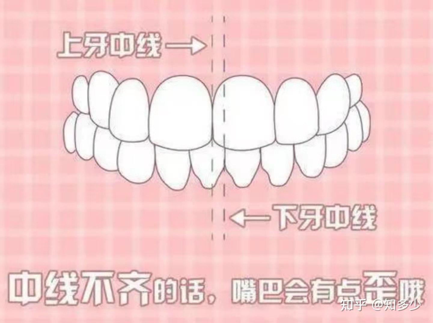 孩子换牙详细图表 对照年龄看看有几颗牙