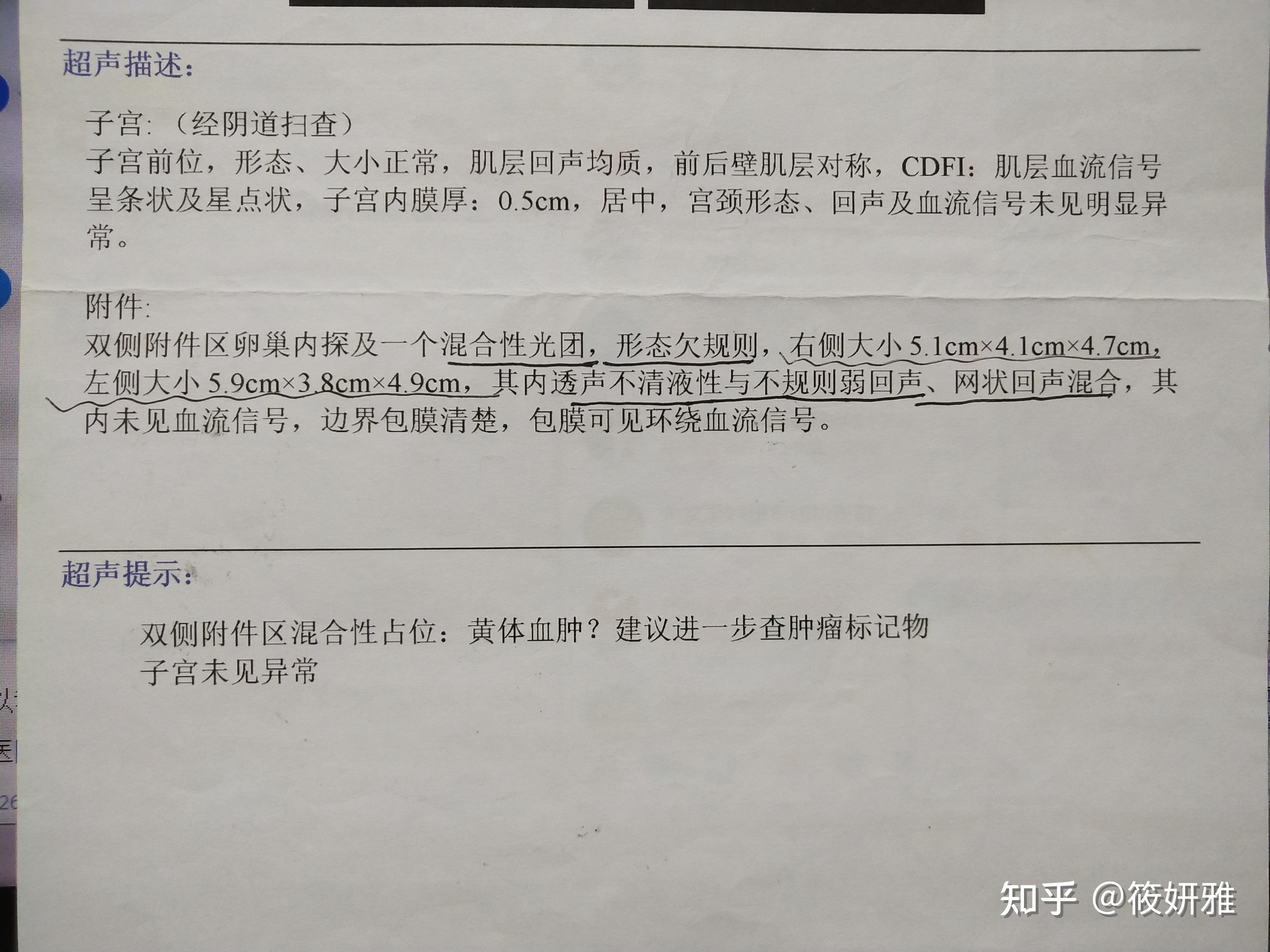 巧克力囊肿可以怀孕吗图片