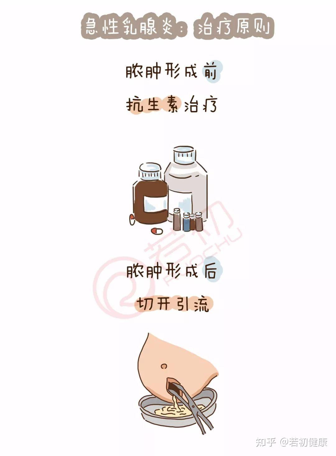 科普漫畫023期:乳房紅腫熱痛,反覆不愈,當心乳腺炎! - 知乎