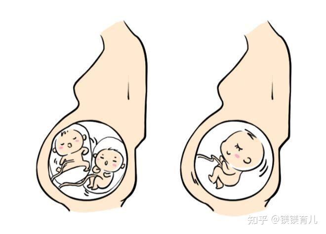 宝宝膀胱位置图片图片