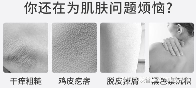 鸡皮肤会不会被疫情传染(鸡皮肤会不会被疫情传染给别人) 鸡皮肤会不会被疫情传染(鸡皮肤会不会被疫情传染给别人)