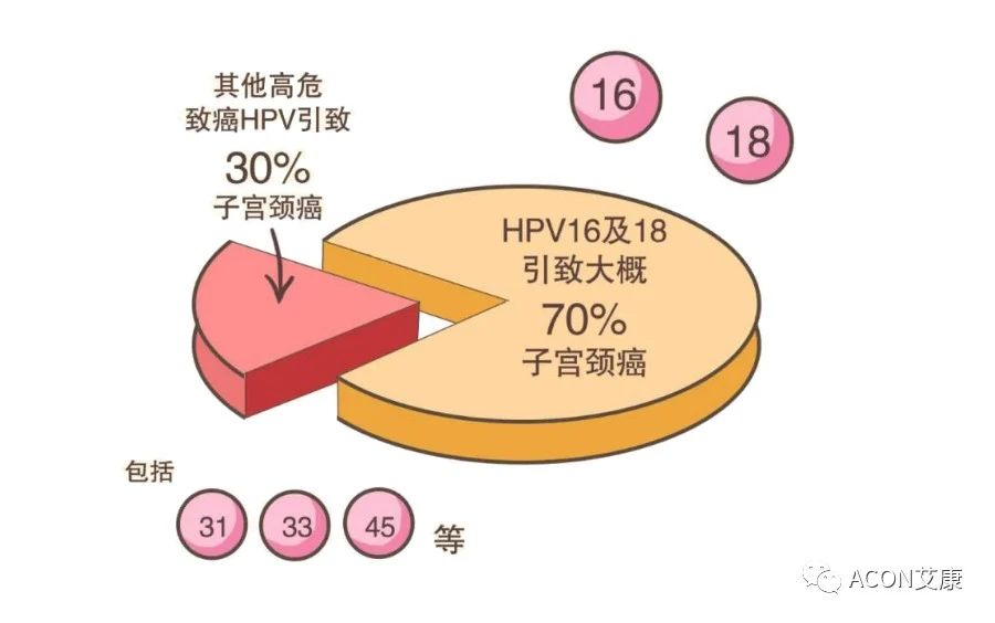 从hpv感染到宫颈癌,是个漫长过程