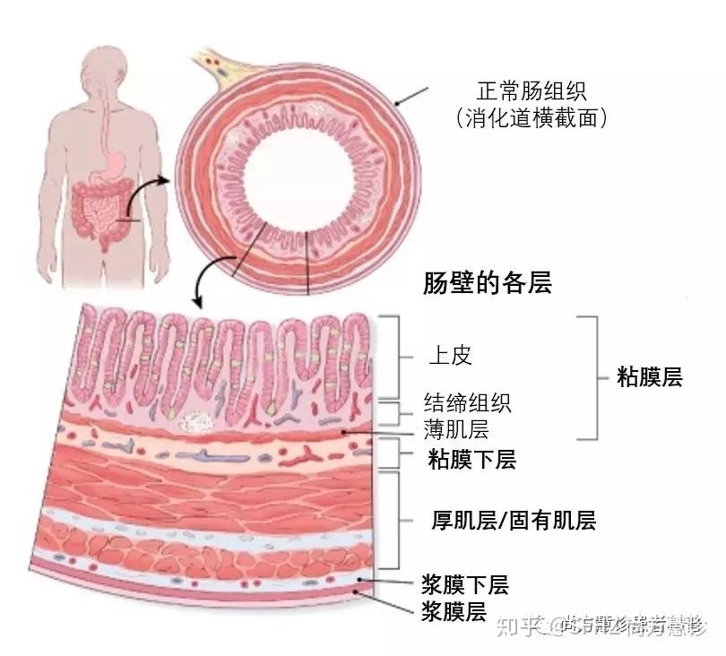 肠壁分层5层示意图图片