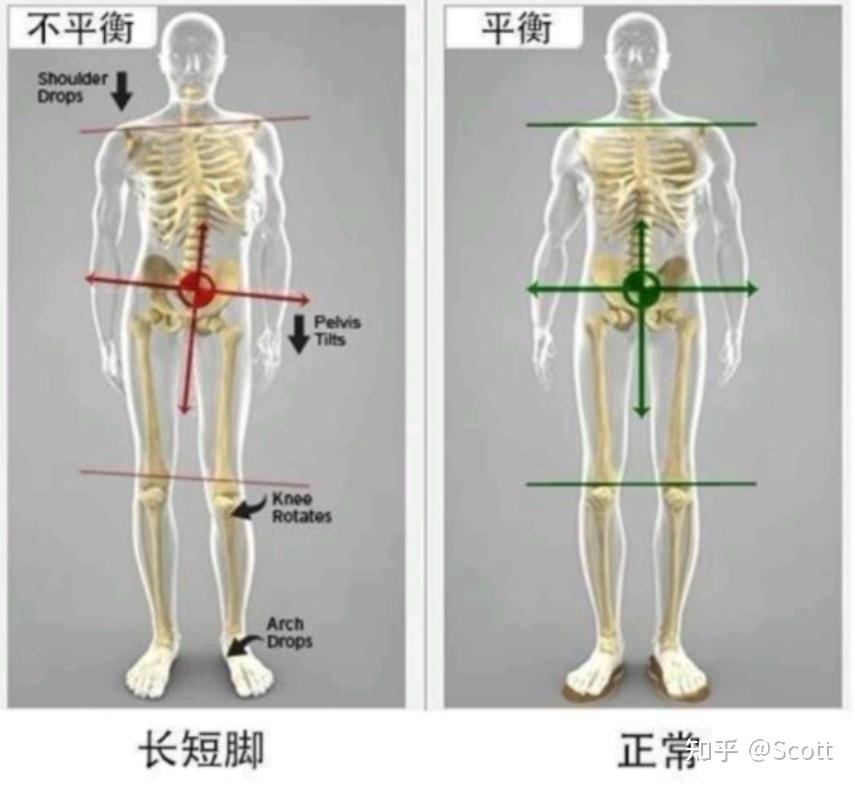 体态管理新理念——全身体态肌骨管理 - 知乎