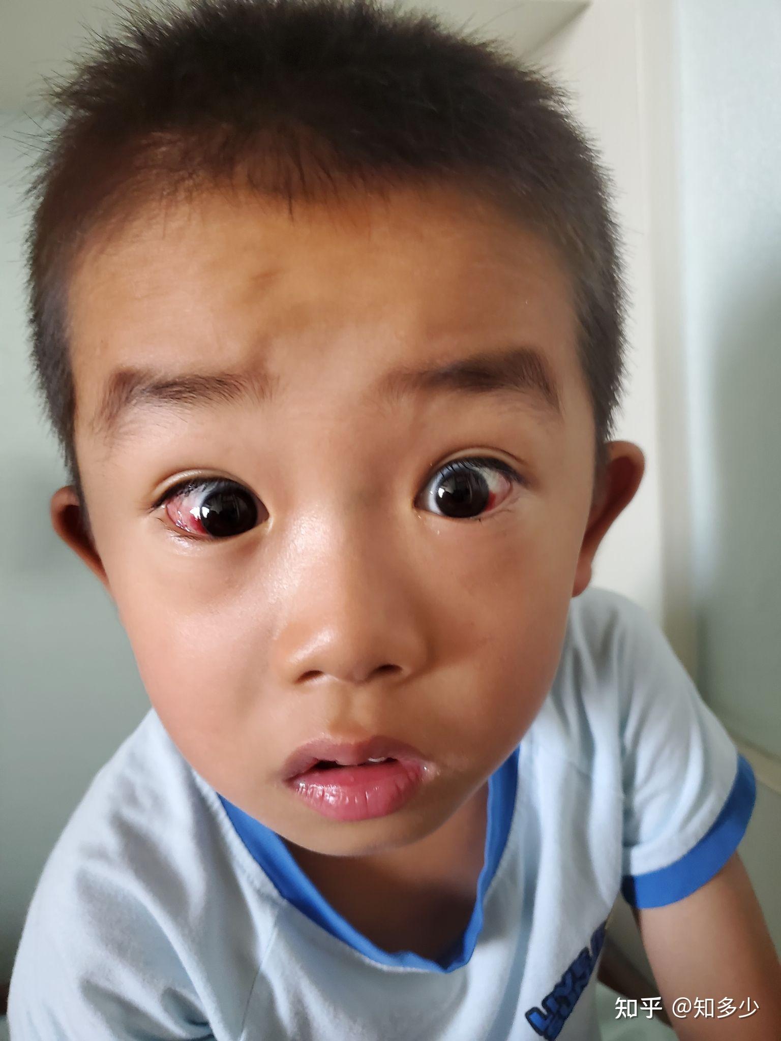 关注儿童视力健康，及时就医-京东健康