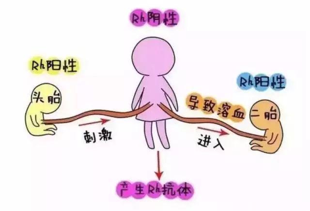 Rh因子如何影响妊娠的?如何预防溶血性疾病 - 知乎