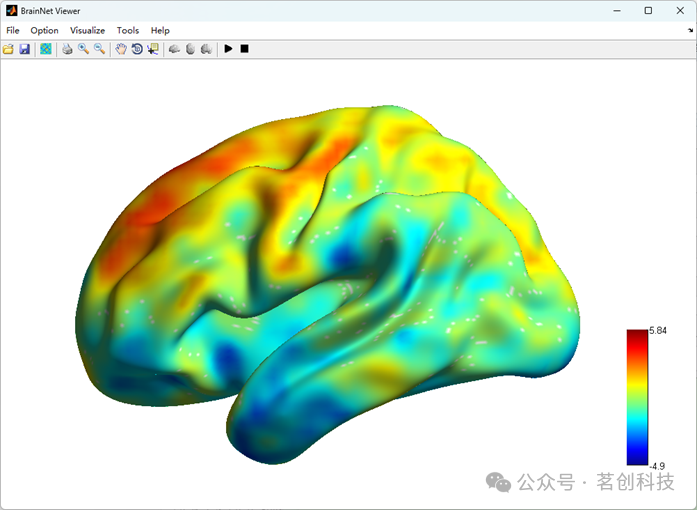 手把手教你使用BrainNet Viewer - 知乎