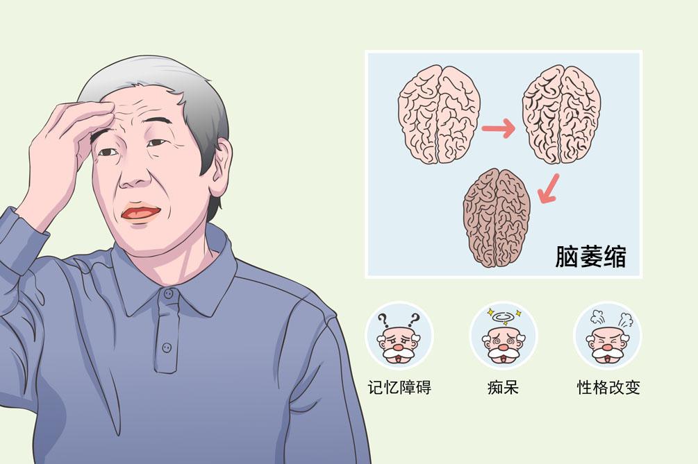 小腦萎縮的症狀有什麼呢