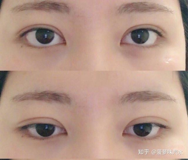下三白眼 - 知乎