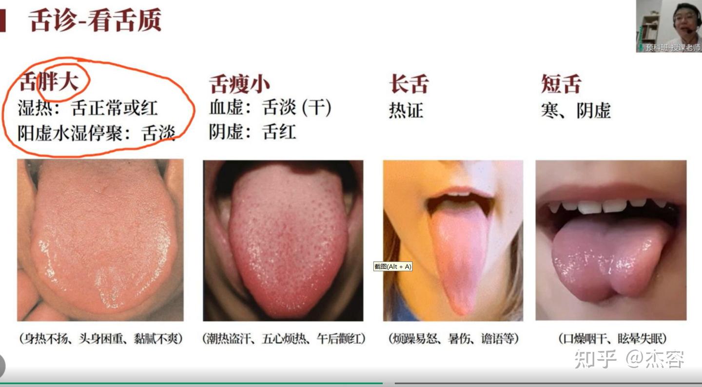中医学习笔记5:舌诊 - 知乎