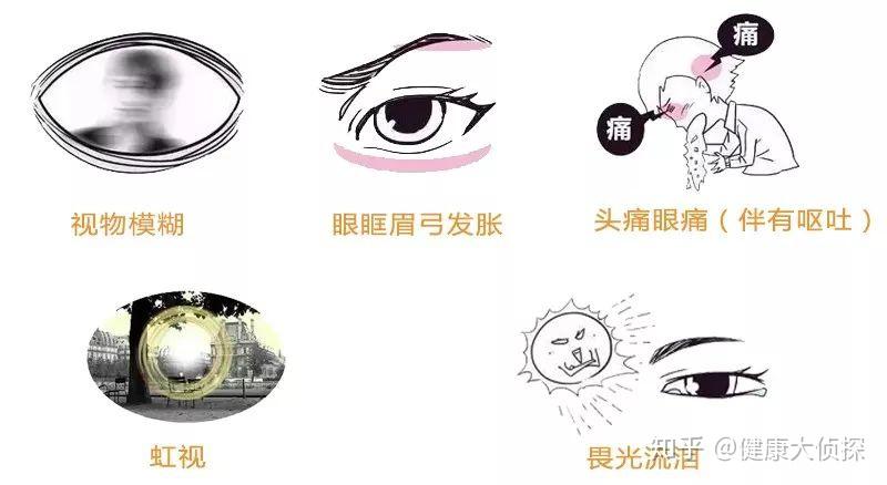 何为青光眼 v2-e924136086505f6a615669b86b61385a_r.jpg