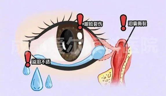 无法自控地流泪,泪道可能已经受伤了! - 知乎