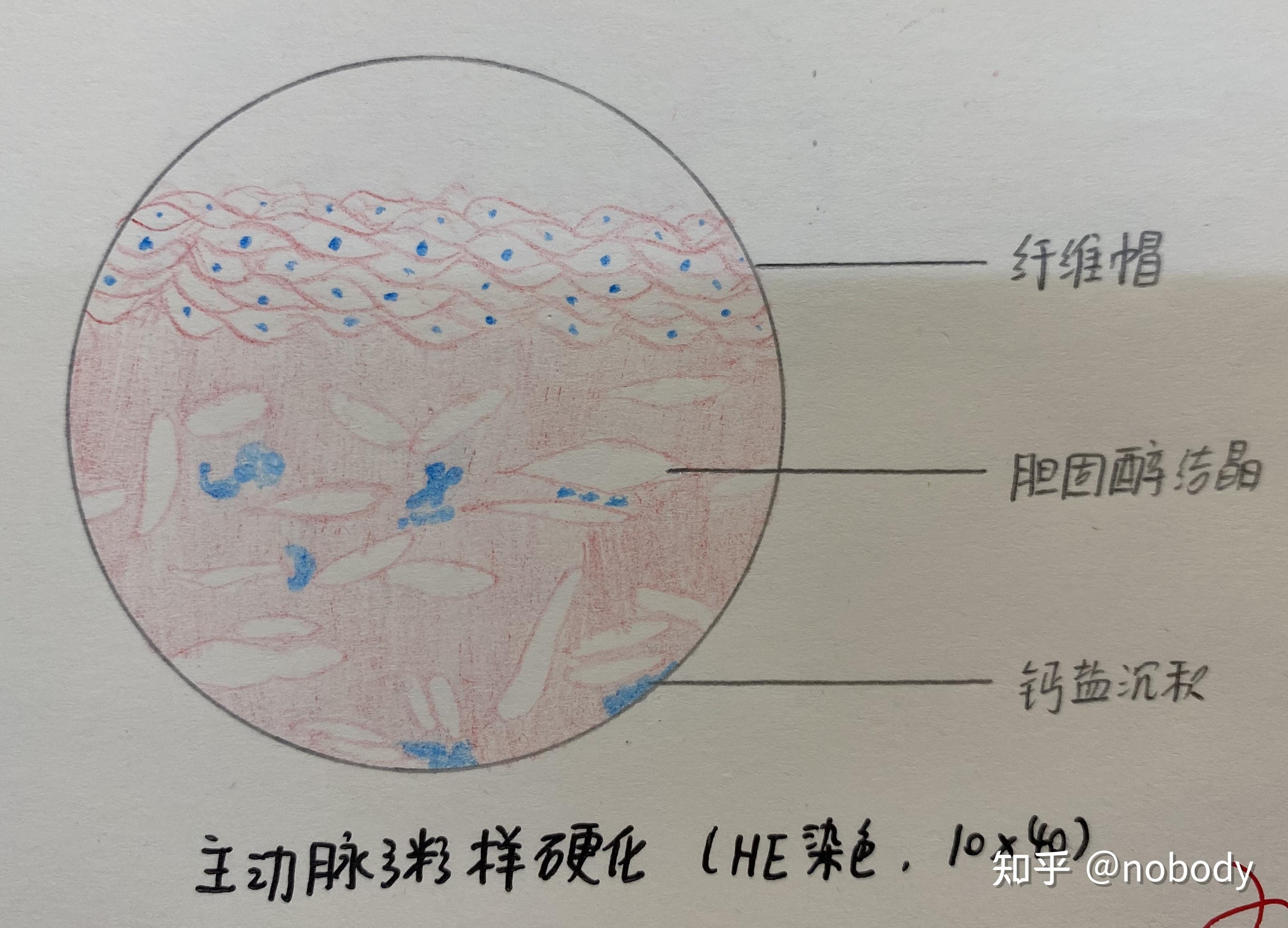 病理學實驗紅藍鉛筆繪圖