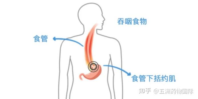 常说的"烧心"到底是哪里在烧?原因可能来自胃! - 知乎