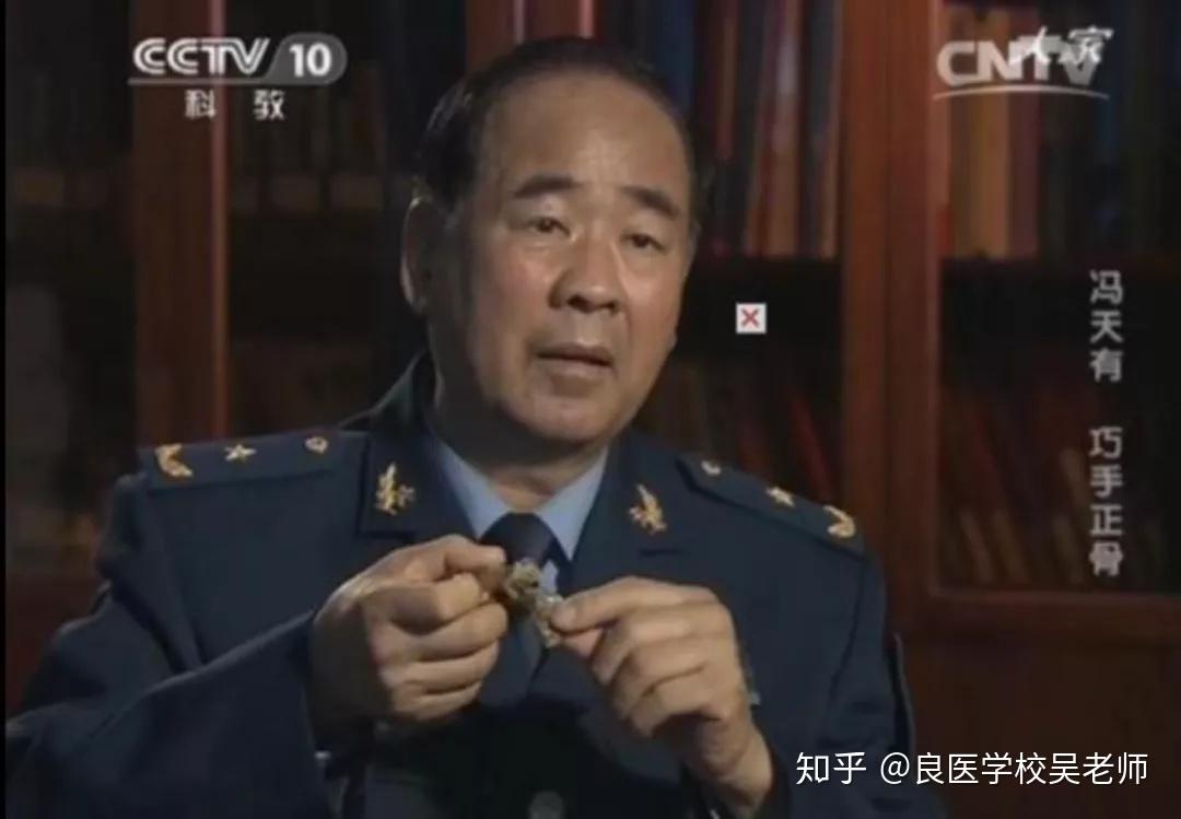 双桥老太太,正骨将军冯天有,新医正骨泰斗仲崇斌-"新医正骨由来"