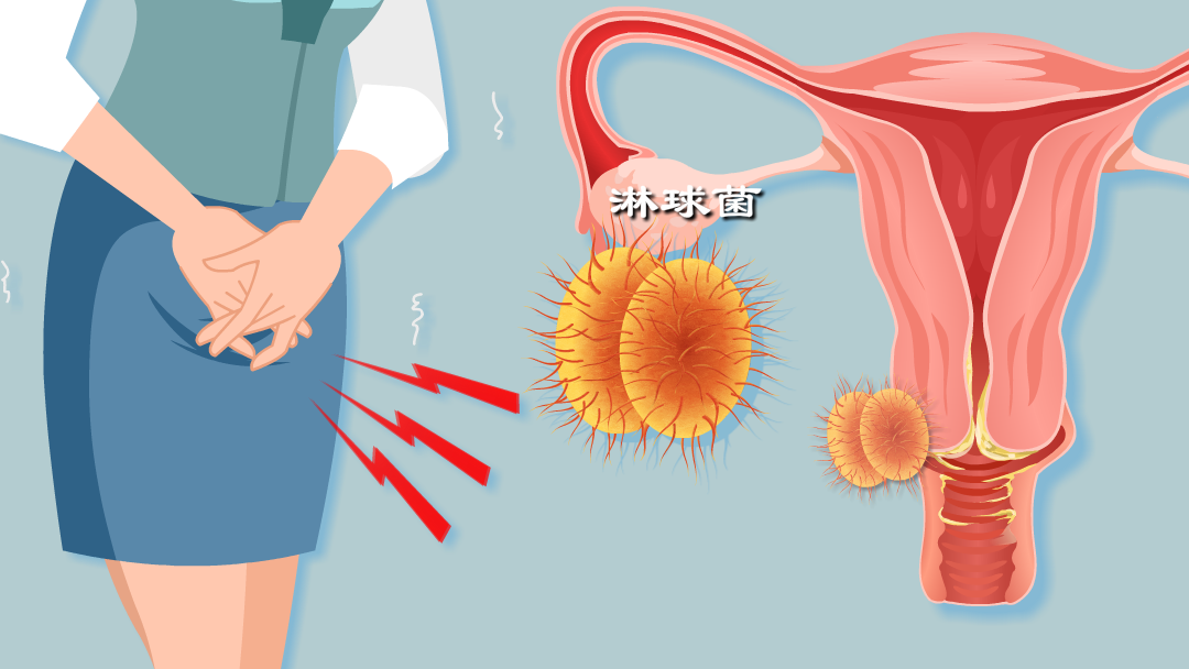 v2-e9a428e4e27585a97efeb171a86a8357_1440w.jpg?source=172ae18b