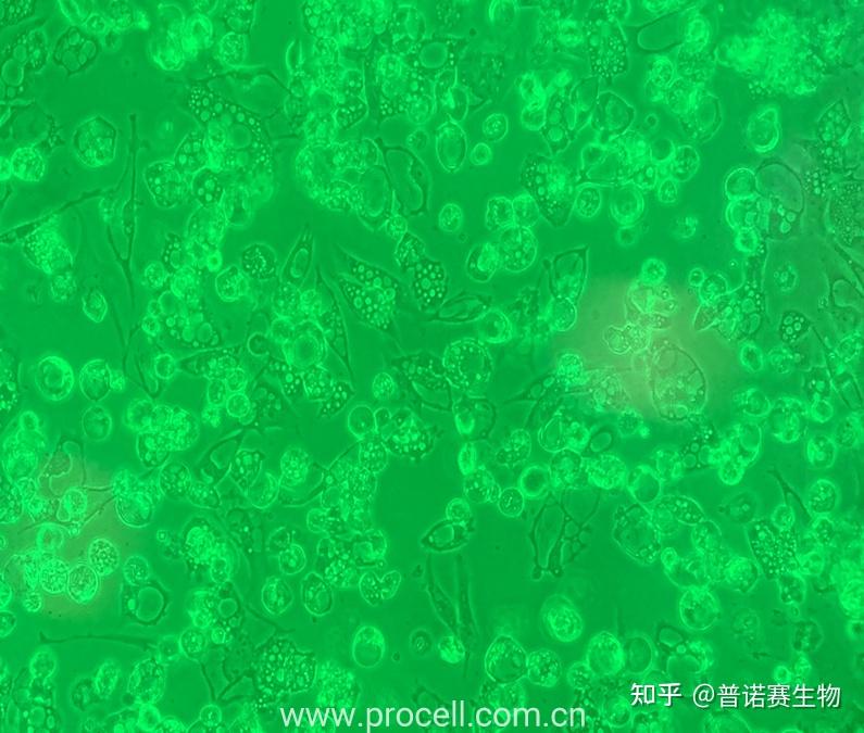 细胞出现空泡,是正常现象吗? - 知乎