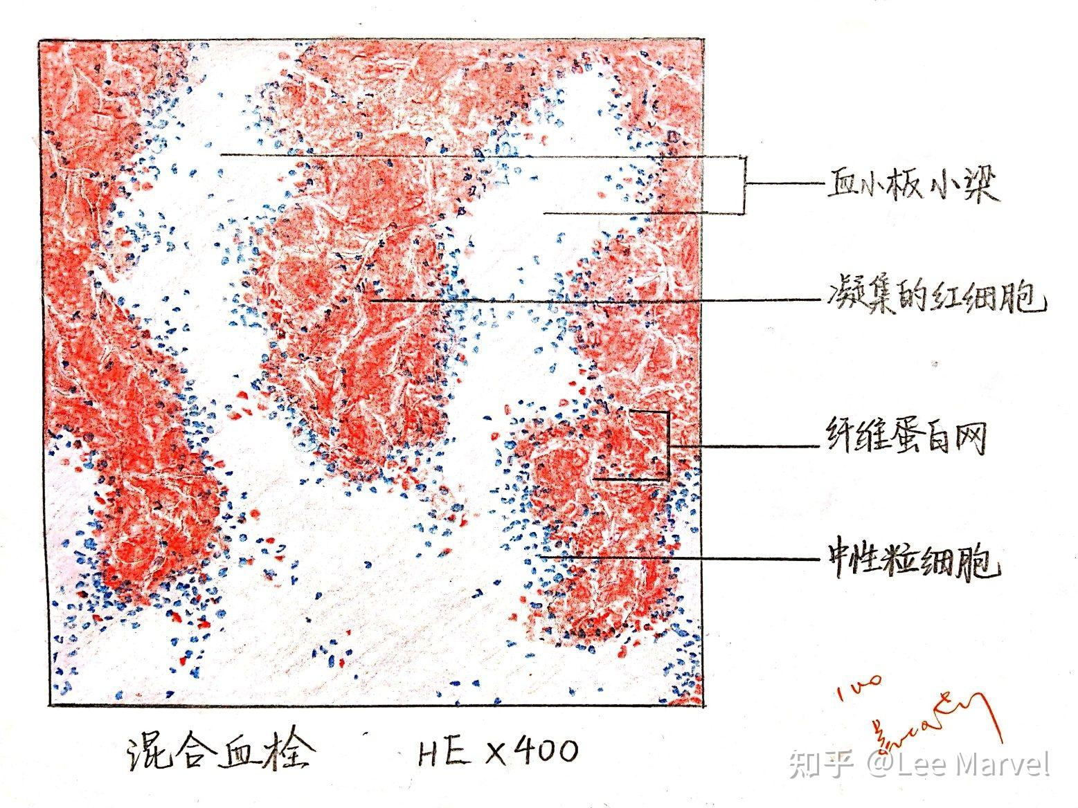 血细胞手绘图红蓝铅笔图片