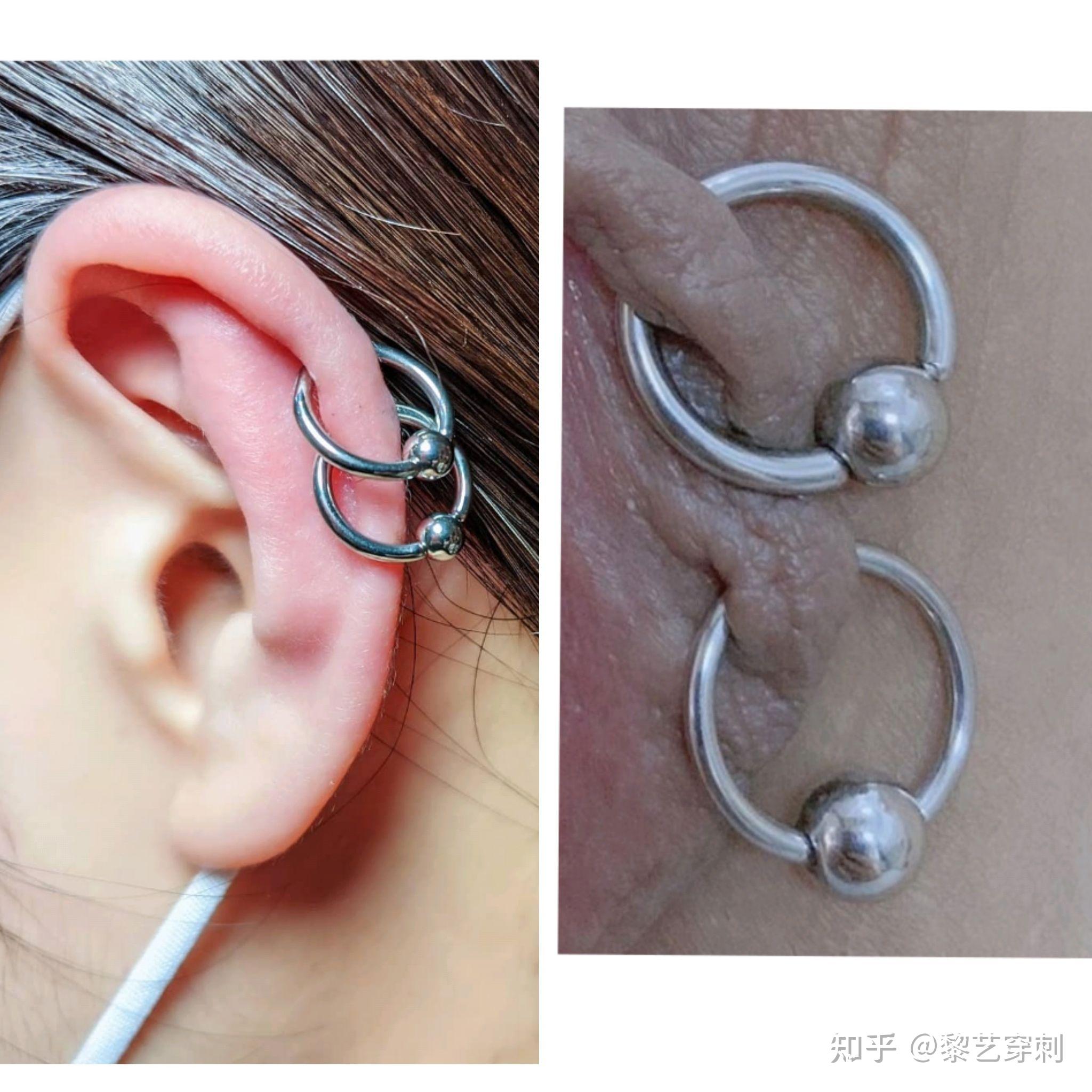 沛县哪里可以打脐钉? - 知乎