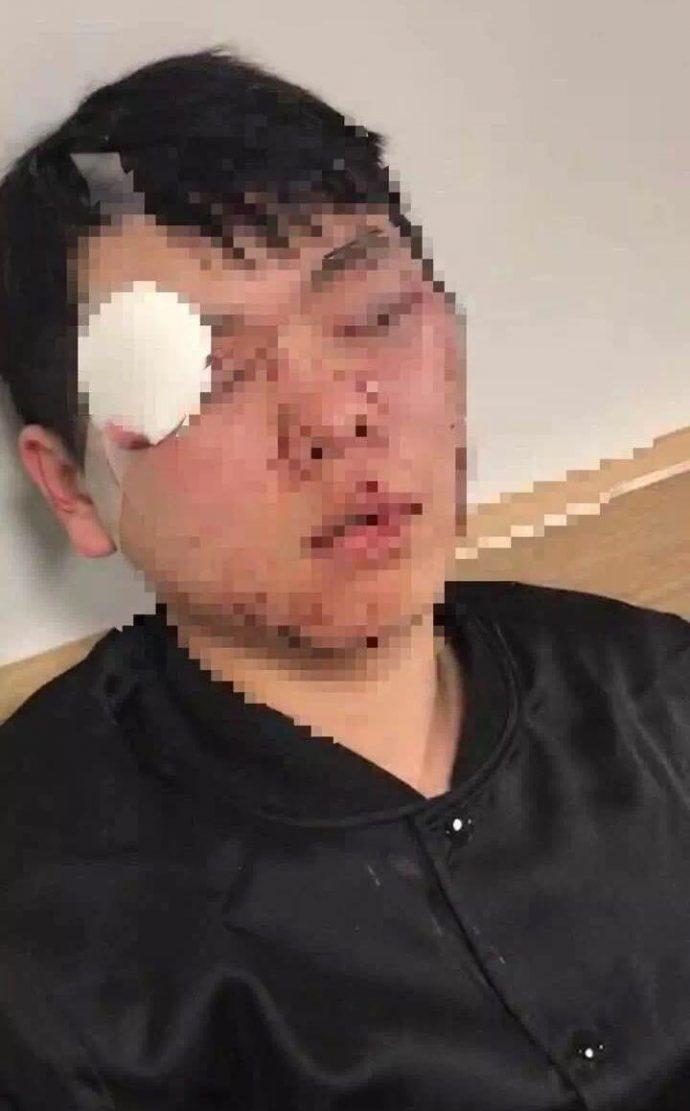 澳大利亚中国留学生遭暴力殴打首都华人自发开车护送同胞