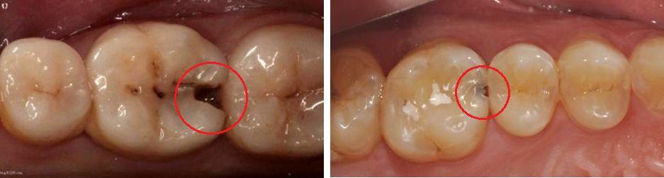 会正确刷牙还不够