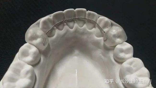 实现保持器自由?保持器也能diy? - 知乎