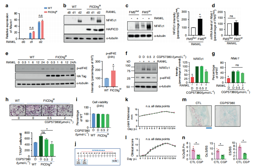 macrophage migration inhibitory factor drives pathology in a