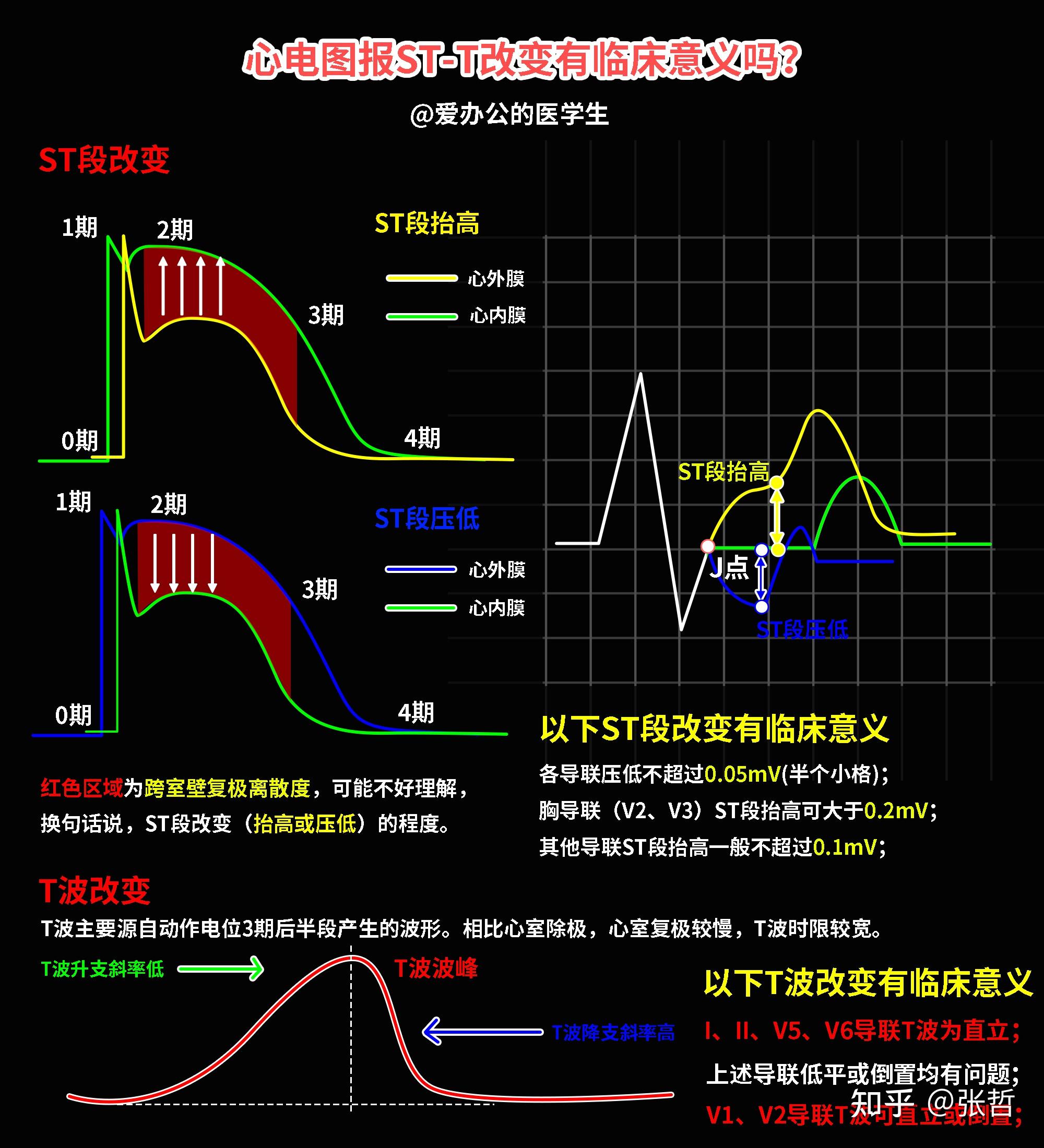 心电图首饰寓意图片